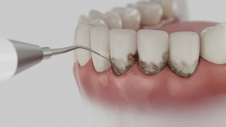 Reliable Wisdom Tooth Removal contractor in Escambia County County, AL by Dentist Open Now